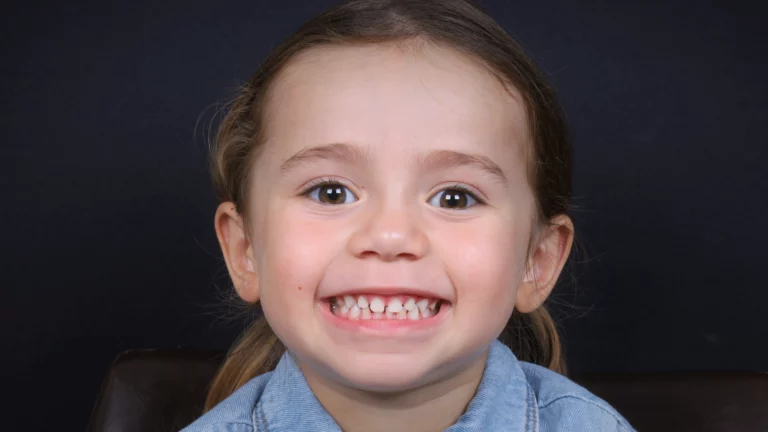 Criança a sorrir, com os dentes visíveis.