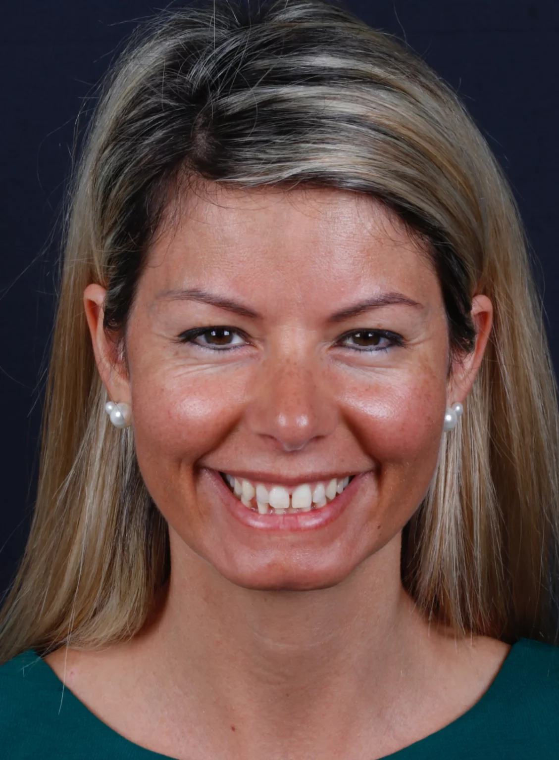 Retrato frontal de mulher a sorrir, com um espaço visível entre os dentes da frente.