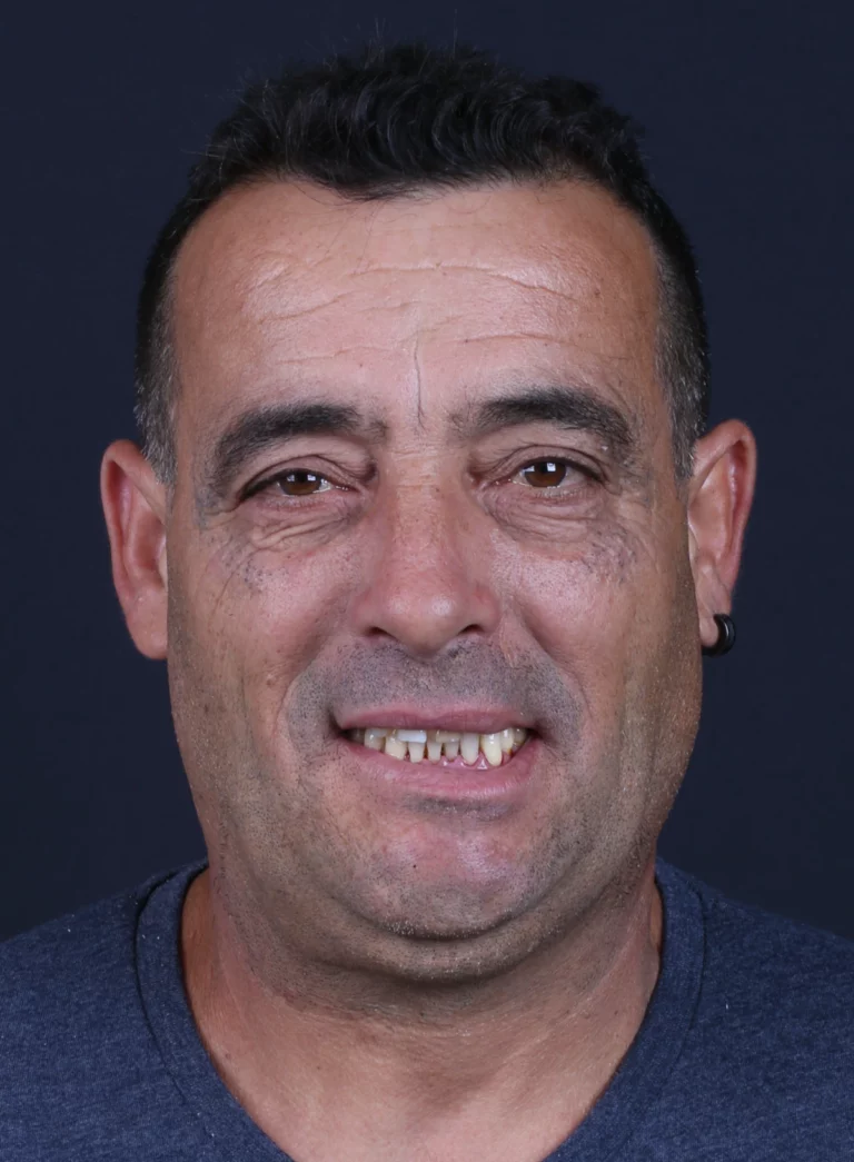 Retrato frontal de homem de cabelo escuro, com os dentes da frente visíveis.