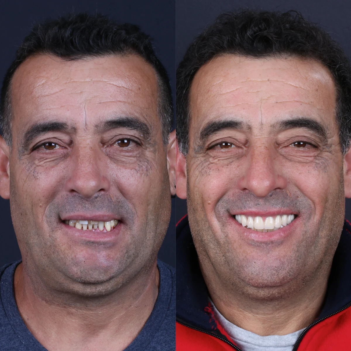 case-12-before-after