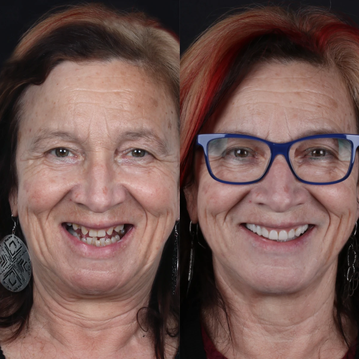case-5-before-after