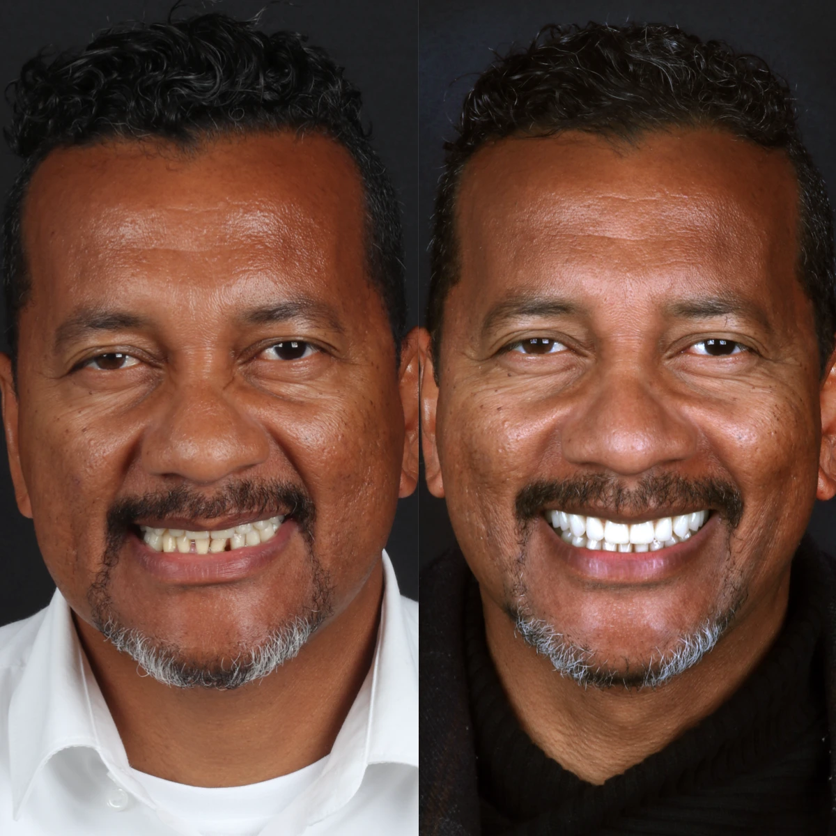 case-6-before-after