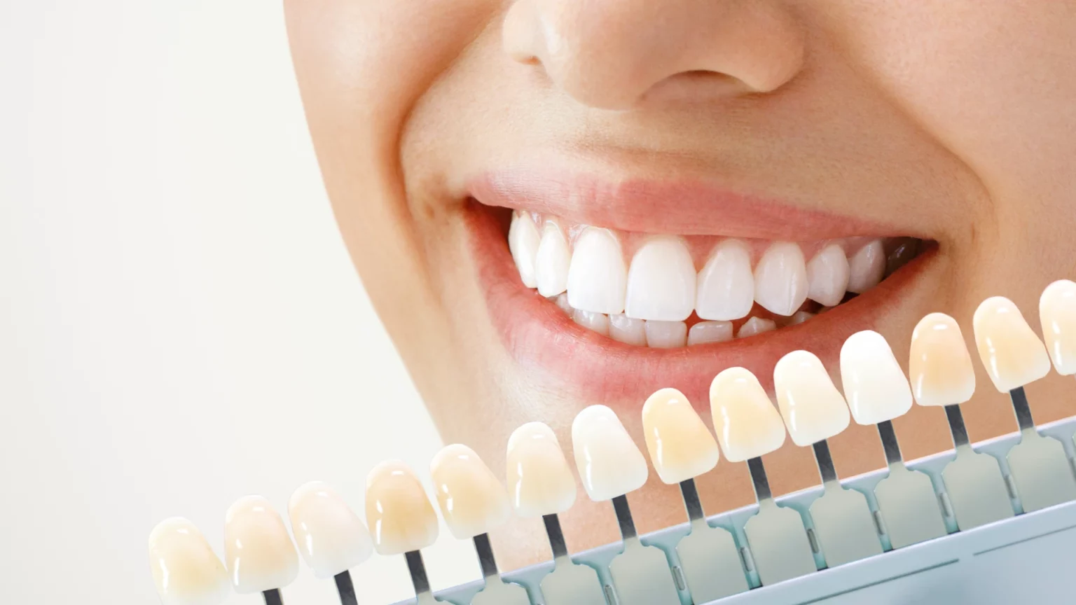 Sorriso junto de uma escala de cor dentária.